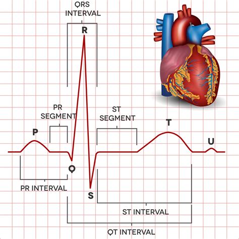 ecg heart diagram 